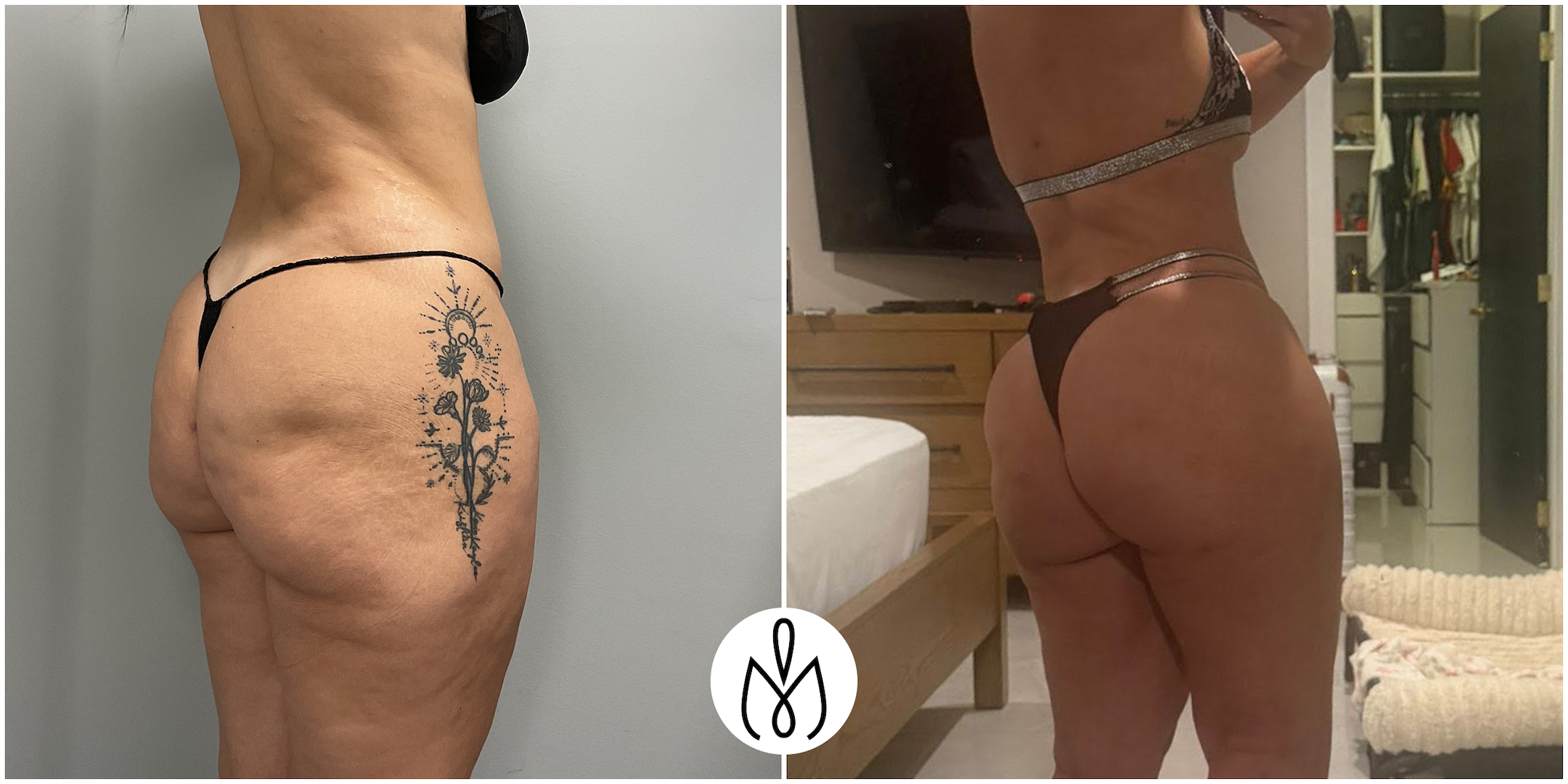 Before,After