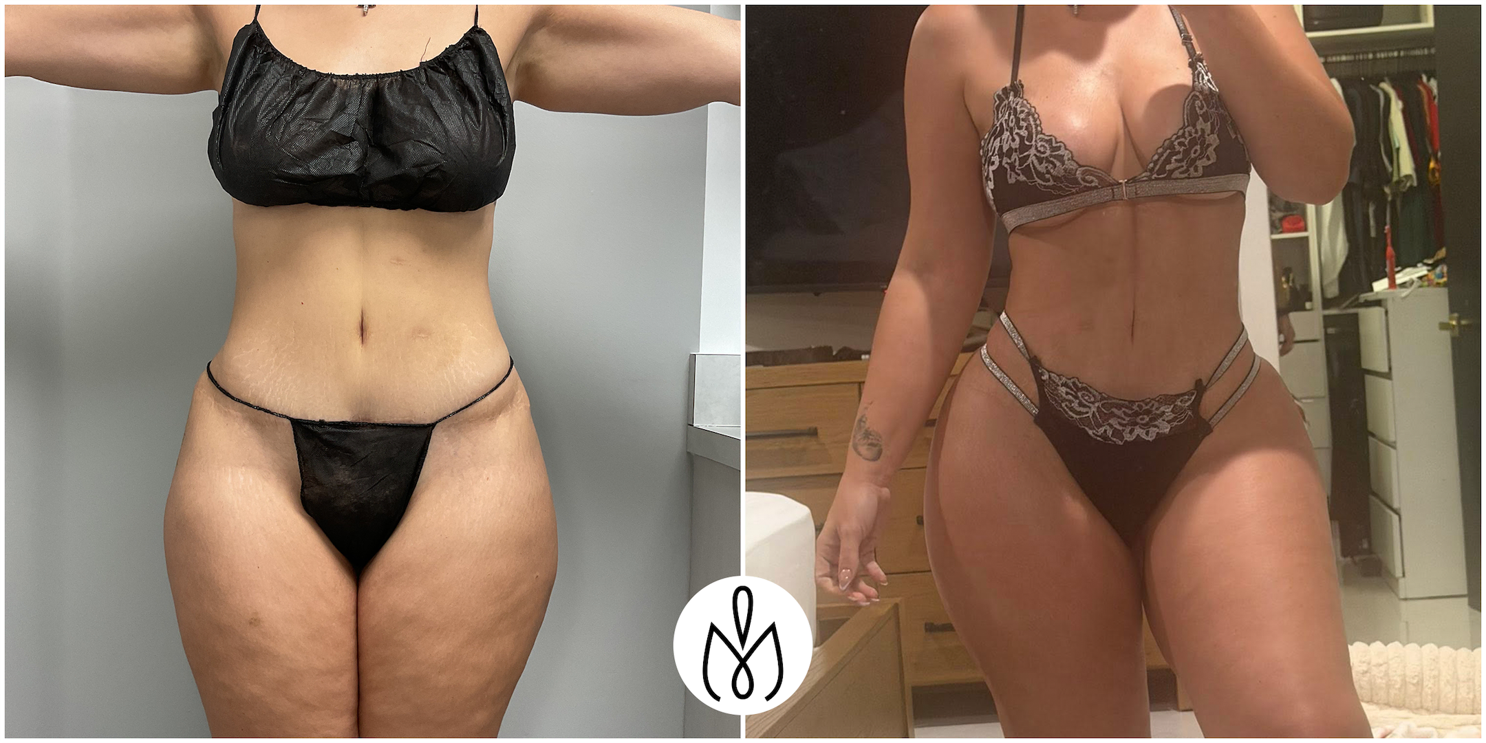Before,After