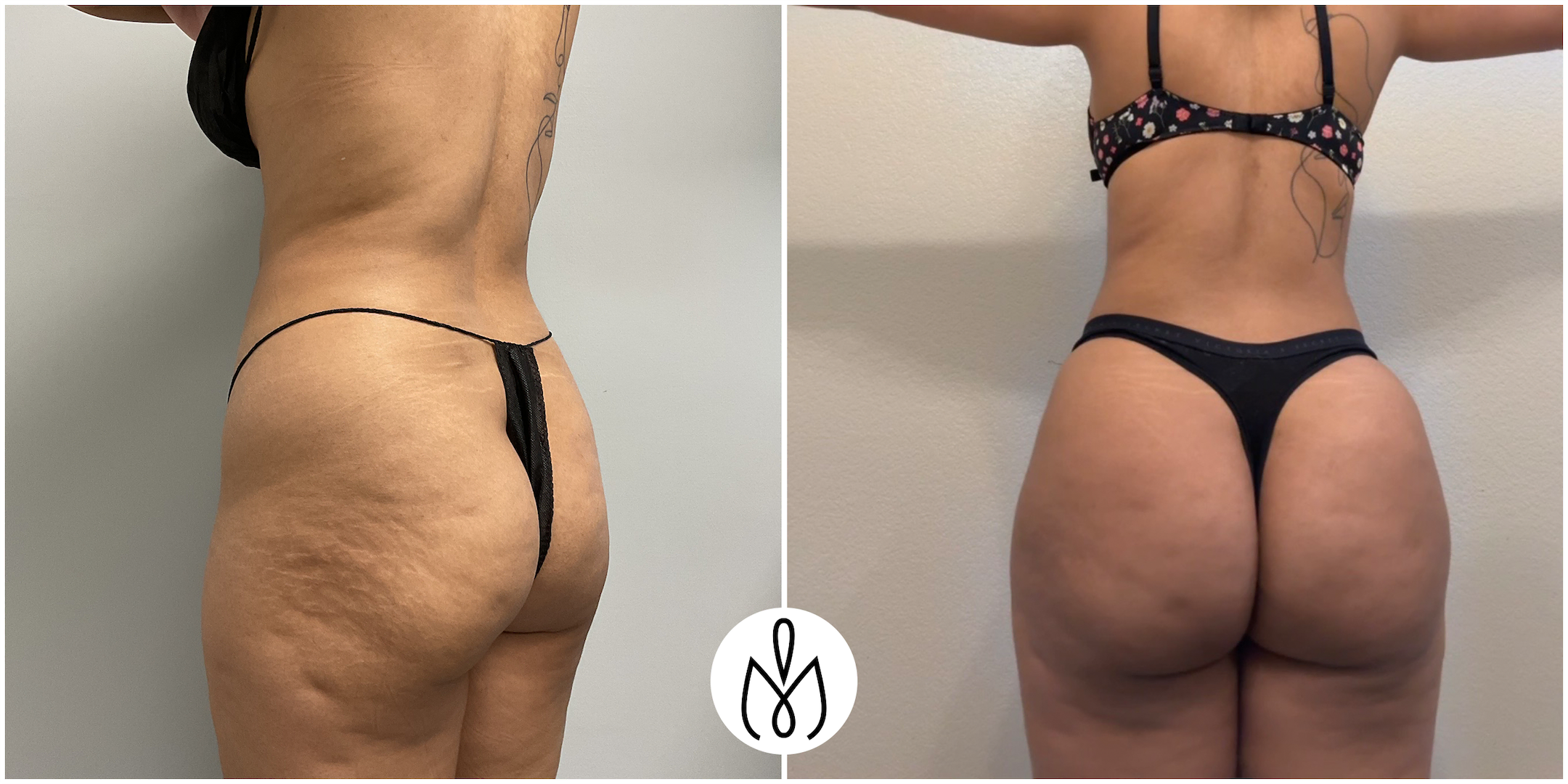 Before,After