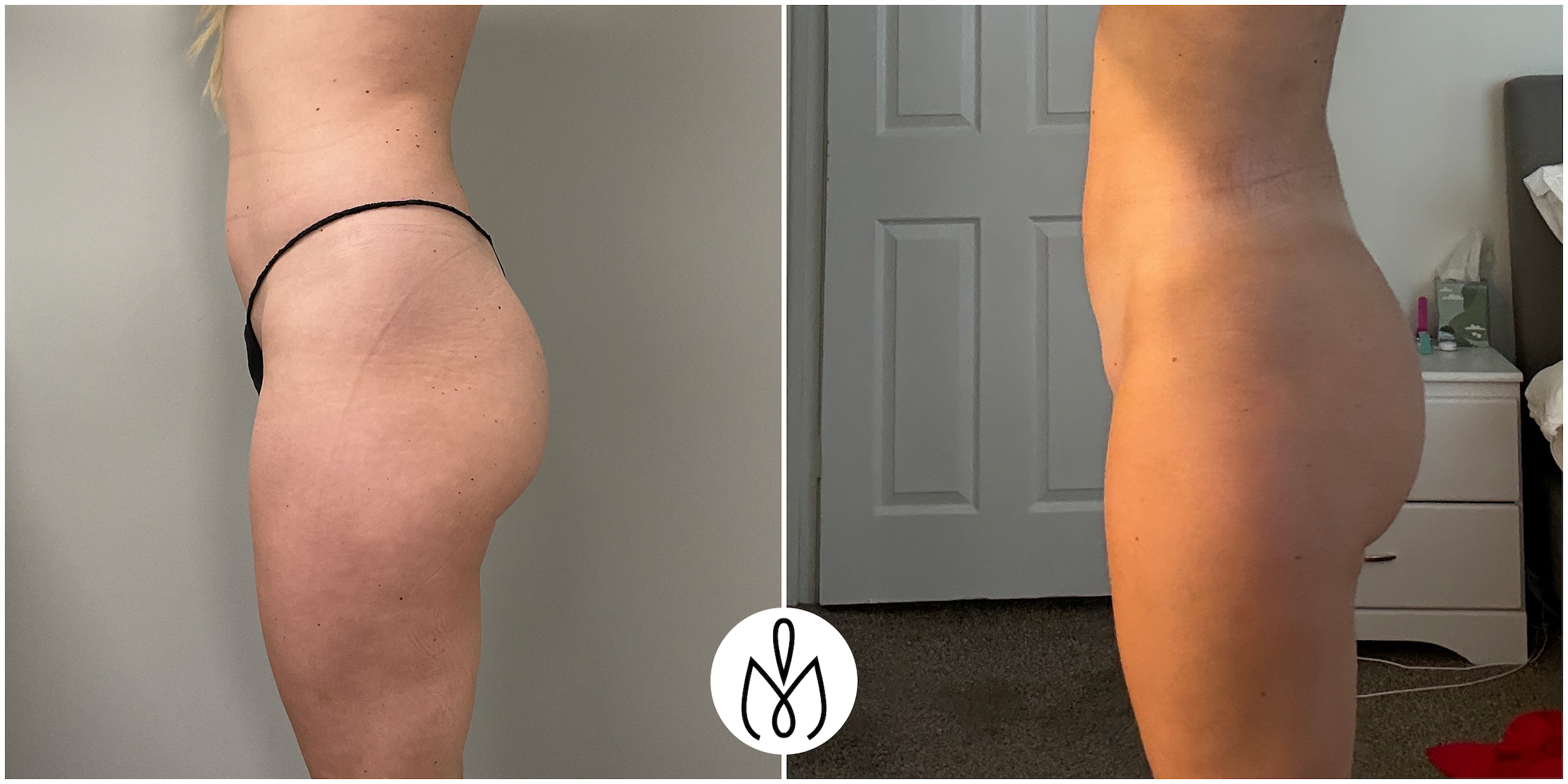 Before,After