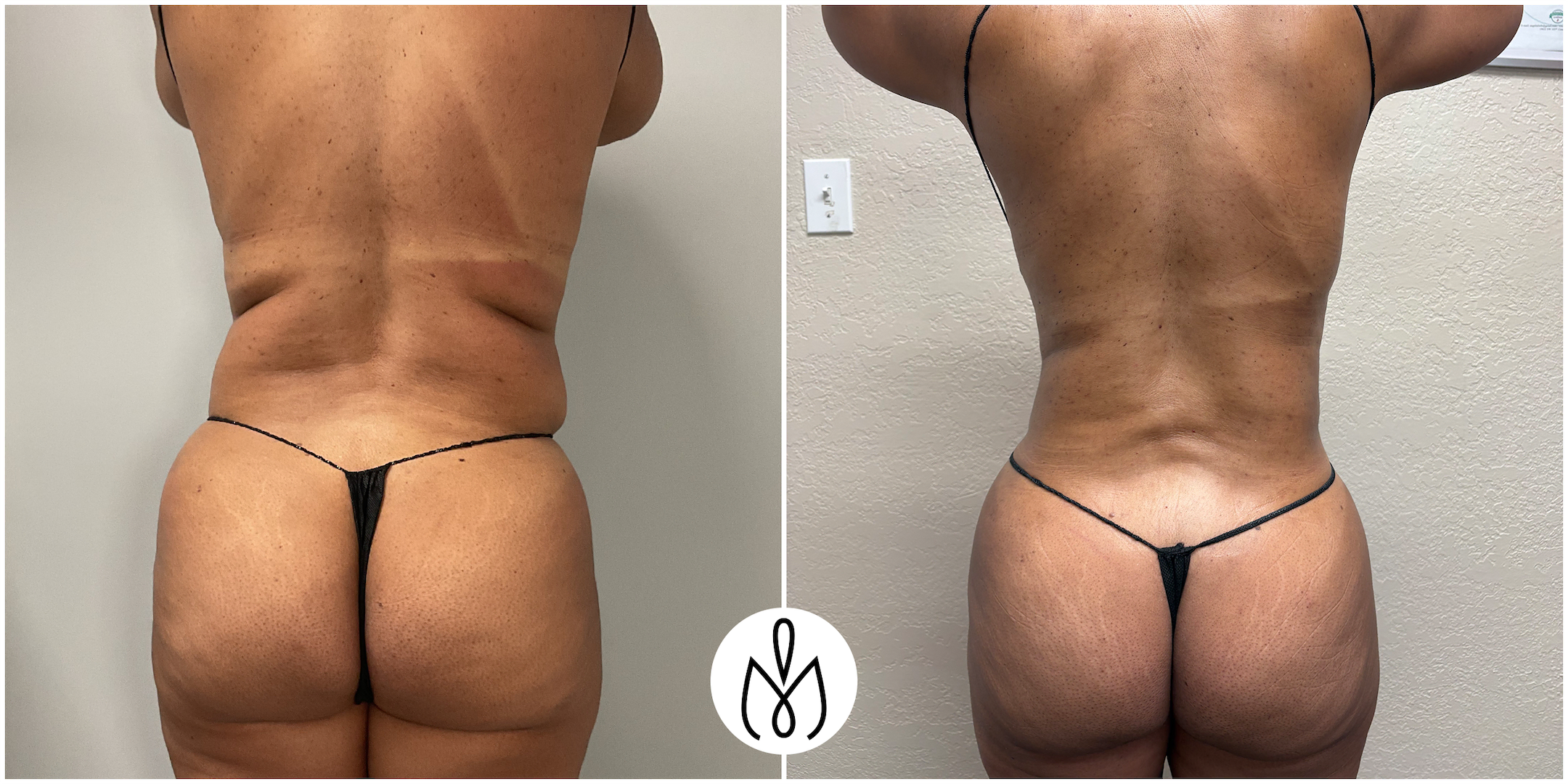 Before,After