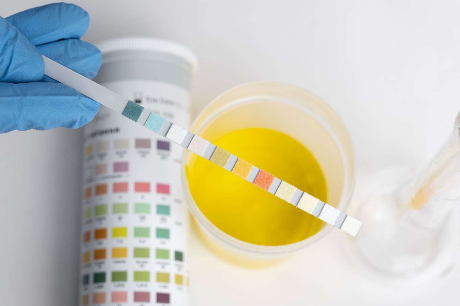 A gloved hand holds a urine test strip above a sample cup filled with yellow liquid, with a color chart and lab glassware in the background, emphasizing the importance of HIOP if the test is failed