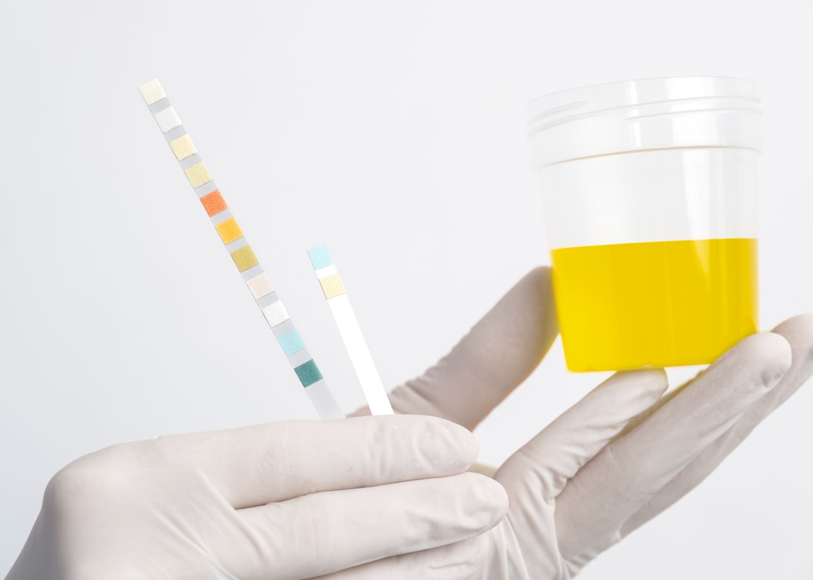 A urine sample being tested, illustrating how long weed stays in your system and how urine tests detect marijuana metabolites