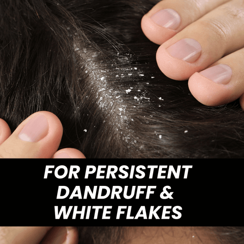 Advanced Dandruff Relief — Keravive scalp treatments
