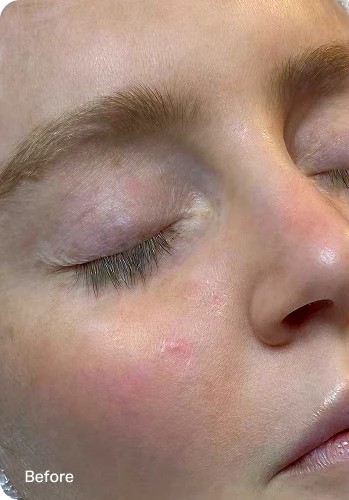 Texture & radiance — before