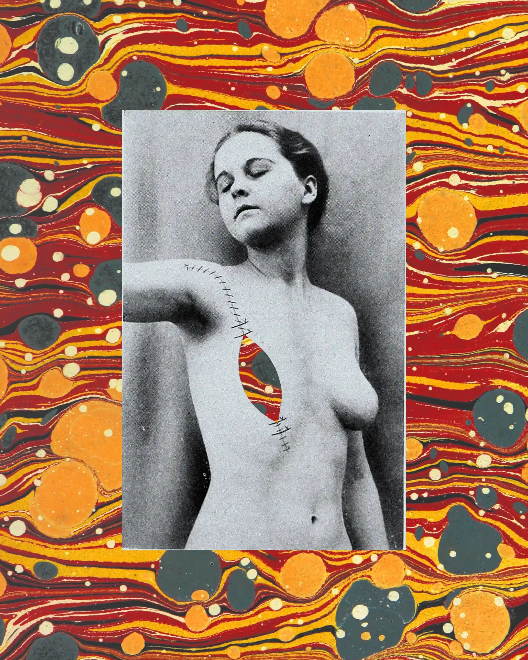 A collage of a 19th century medical texbook image superimposed on marbled paper