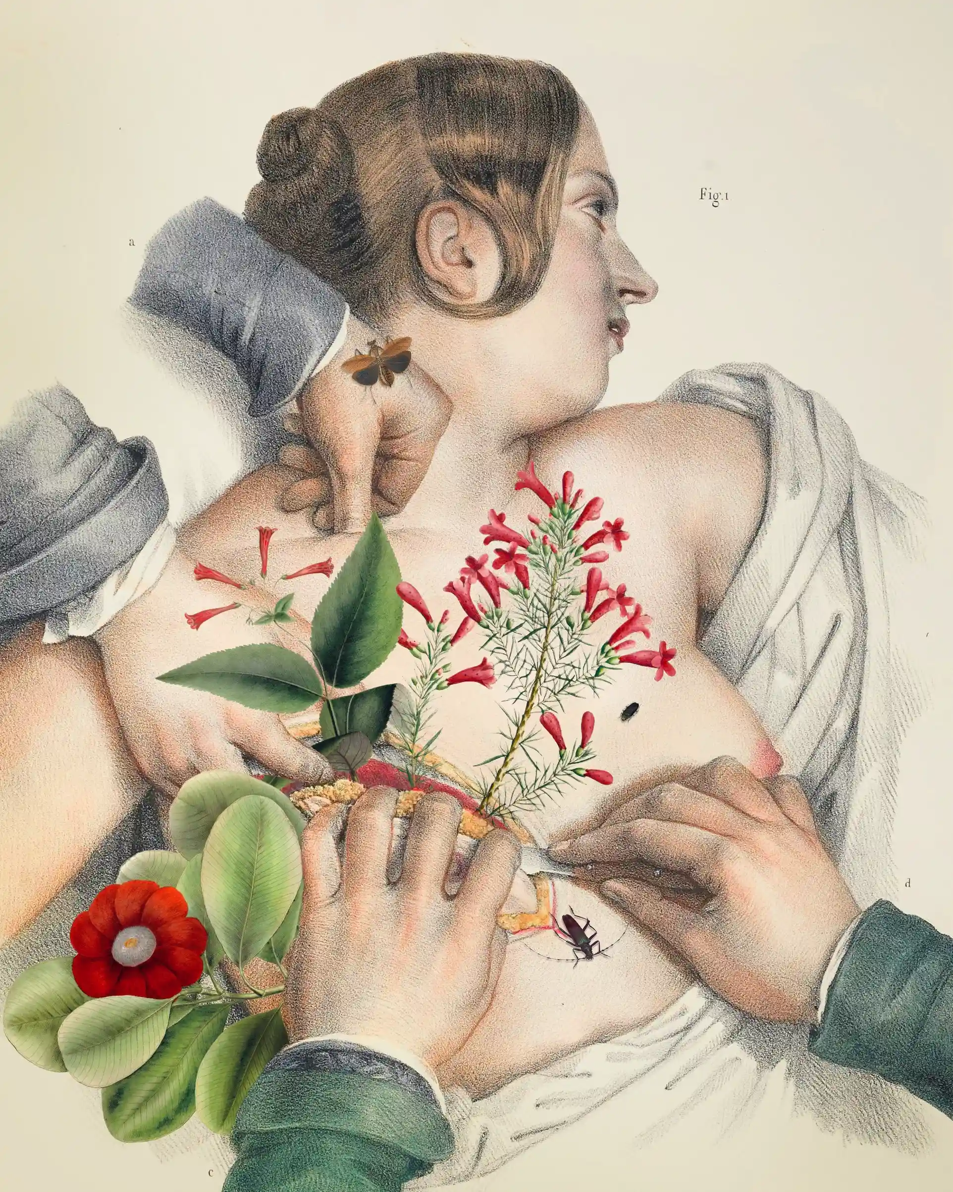A collage of a 19th century surgical image with flowers spilling out of the wound