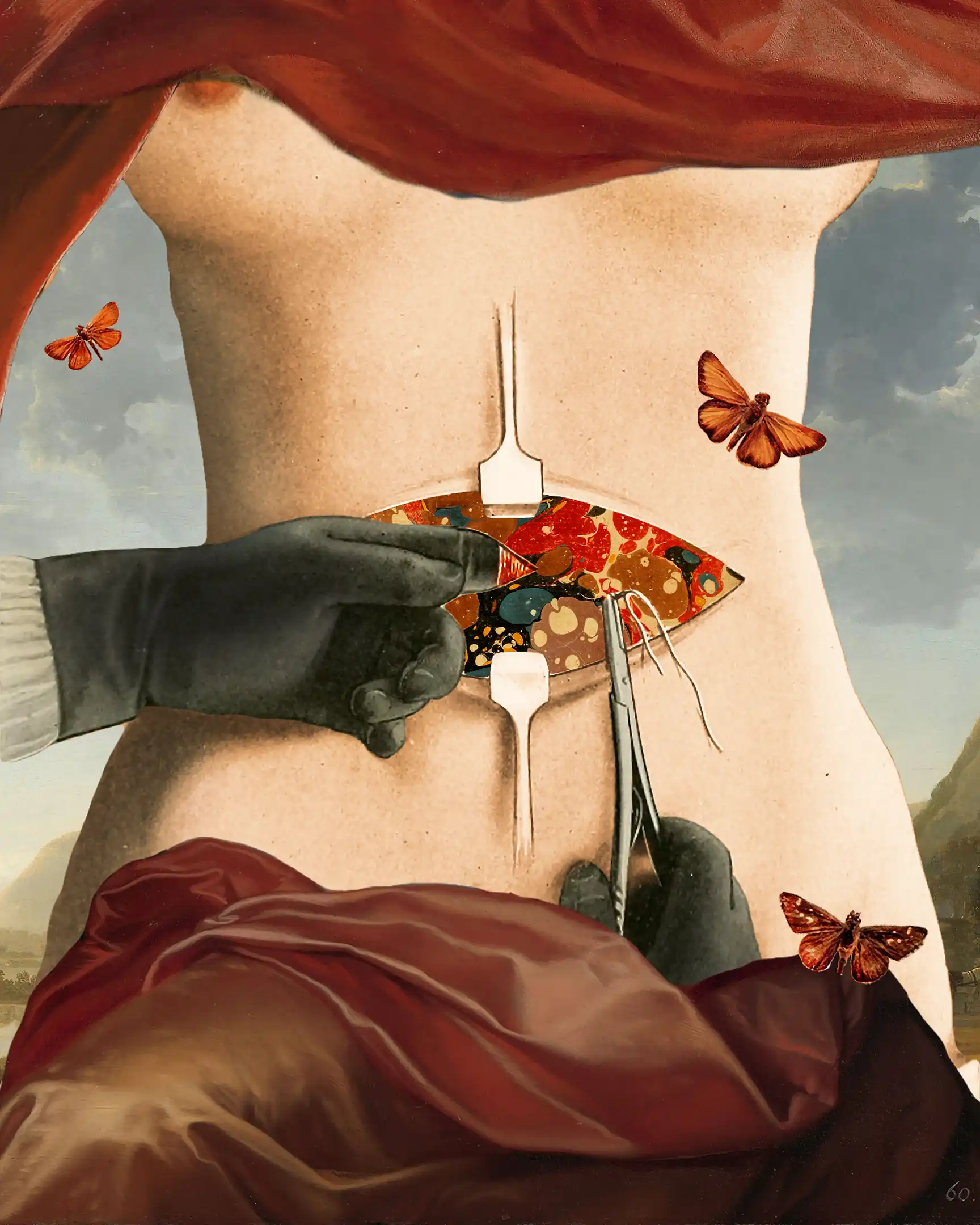 A collage of a draped torso from a 19th century surgical textbook with marbled paper in the wound