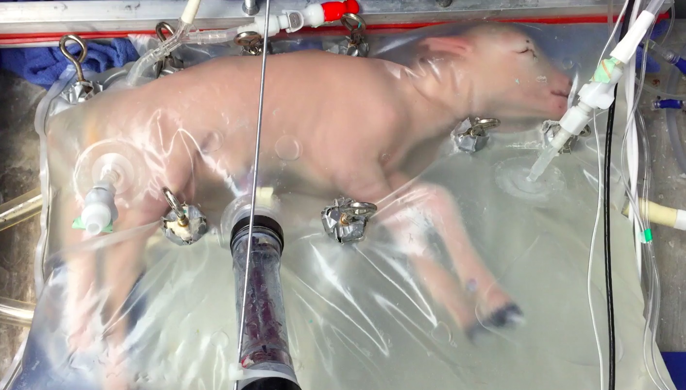 Utérus artificiel, vers une reproduction industrielle des humains