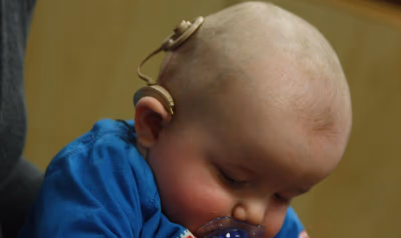 Contre les implants auditifs