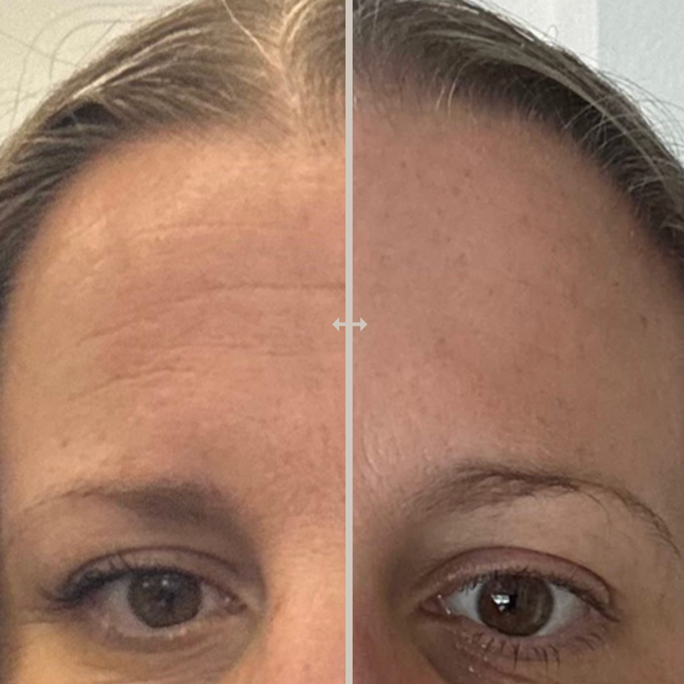 Weight Loss Illustration