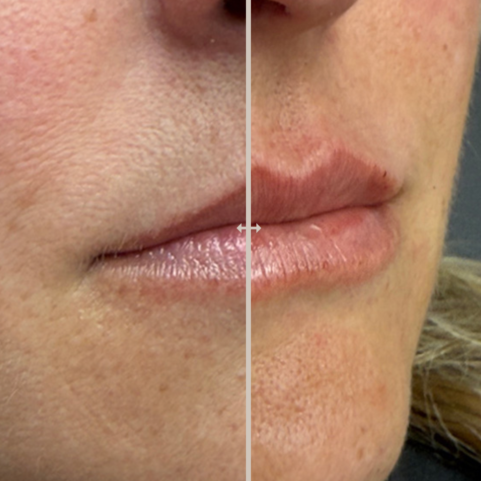 Weight Loss Illustration