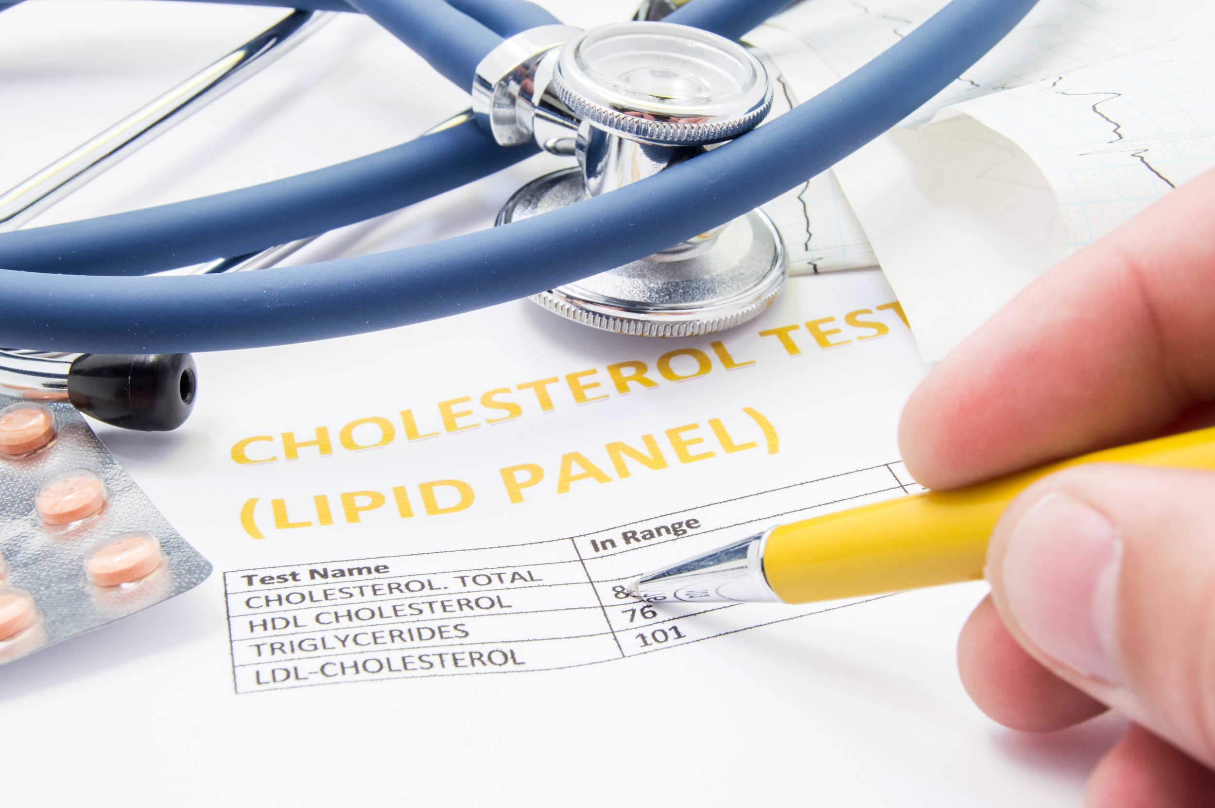 Keep Your Cholesterol in Check, Your Heart Happy, and Your CDL Valid