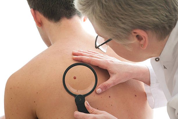Dermatologist identifying precancerous changes on a patient.