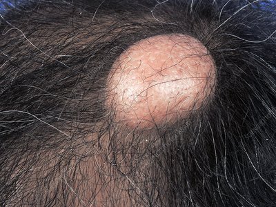 Dermatologists reviewing patient medical history.