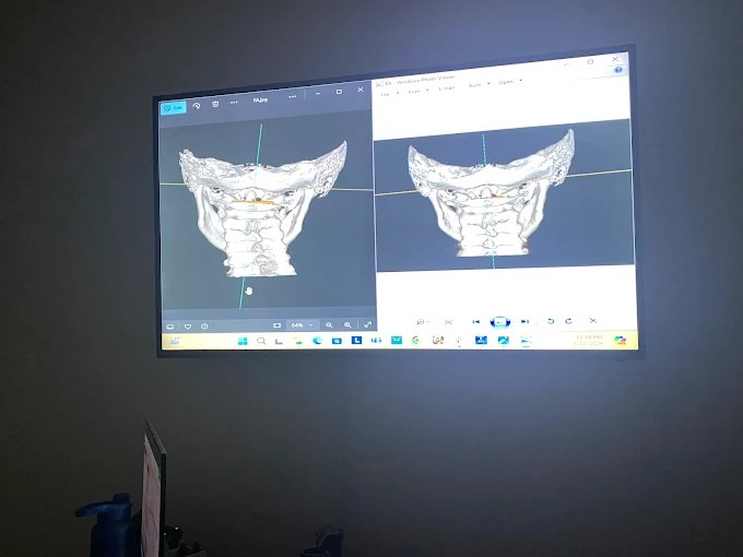 Modern upper cervical chiropractic clinic interior at Peak Upper Cervical Center in Boise Idaho for nervous system and post-concussion care