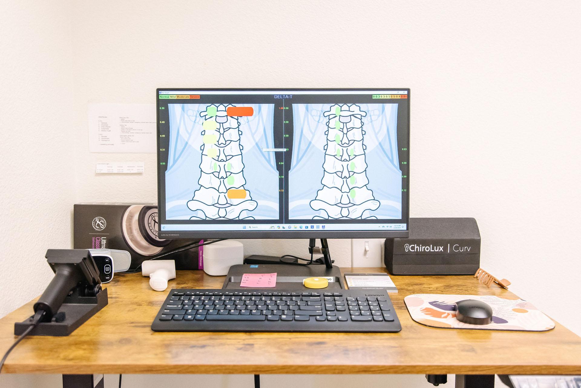 The Upper Cervical Approach at Peak