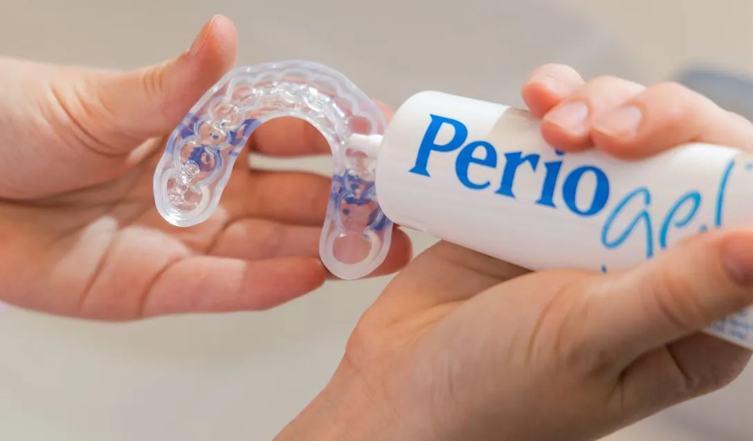 Applying Perio Gel into a dental tray for gum disease treatment using Perio Protect system.