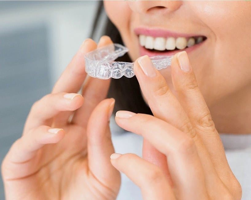 clear aligners being placed on teeth - align