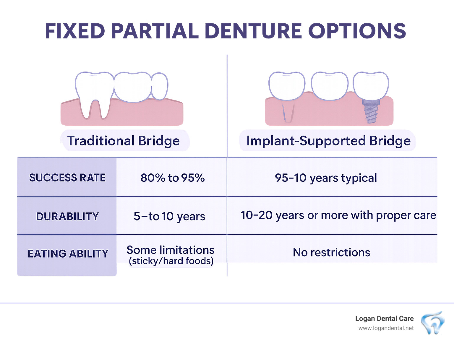 Partial to Dentures? Your Guide to Fixed Partial Denture Options