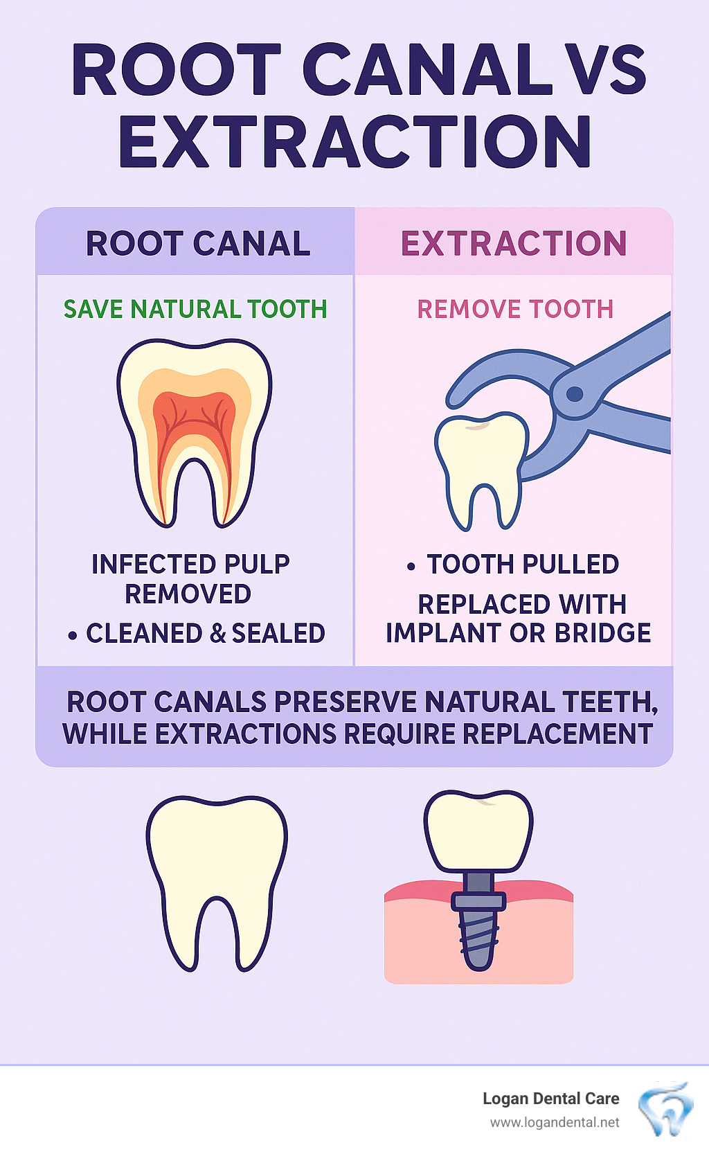 Infographic comparing root canal treatment saving a natural tooth versus extraction removing the tooth and requiring replacement with dental implant or bridge - root canal vs extraction infographic 