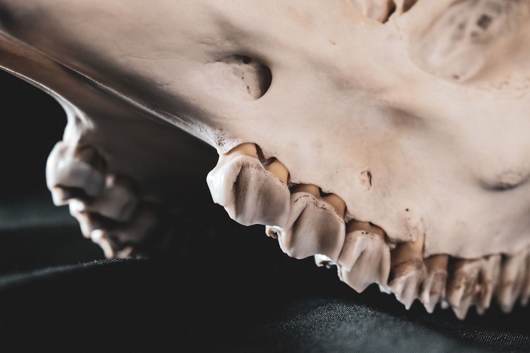 a cracked tooth X-ray - local dentist open today a cracked tooth X-ray - local dentist open today
