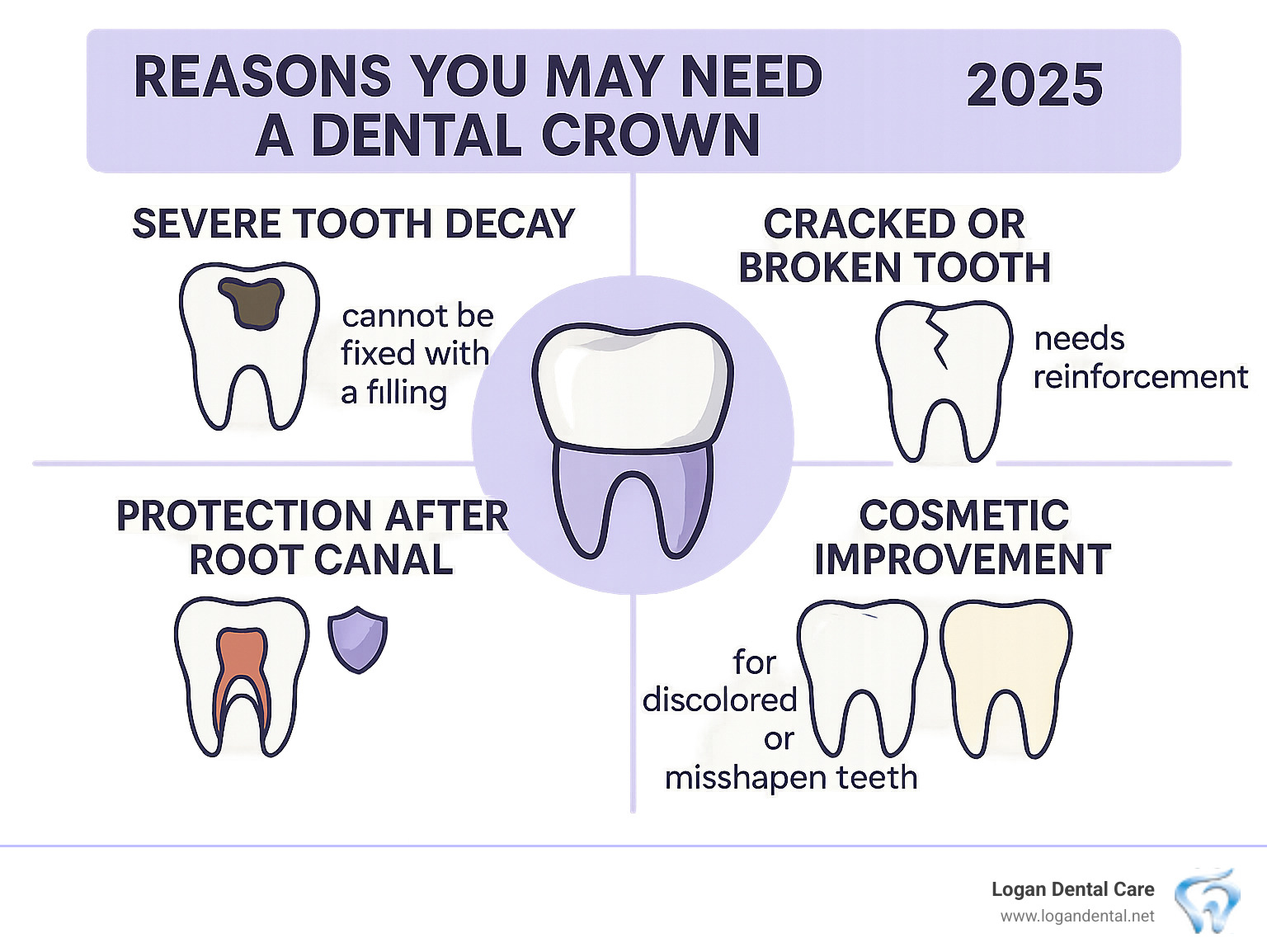 Infographic showing the top 4 reasons you might need a dental crown: severe tooth decay that cannot be fixed with a filling, a cracked or broken tooth that needs reinforcement, protection after a root canal procedure, and cosmetic improvement for discolored or misshapen teeth - dental crowns cost infographic 