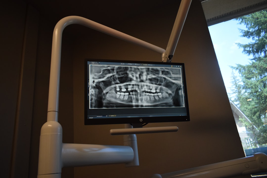 dental X-ray on a screen - tooth extractions Bellefontaine