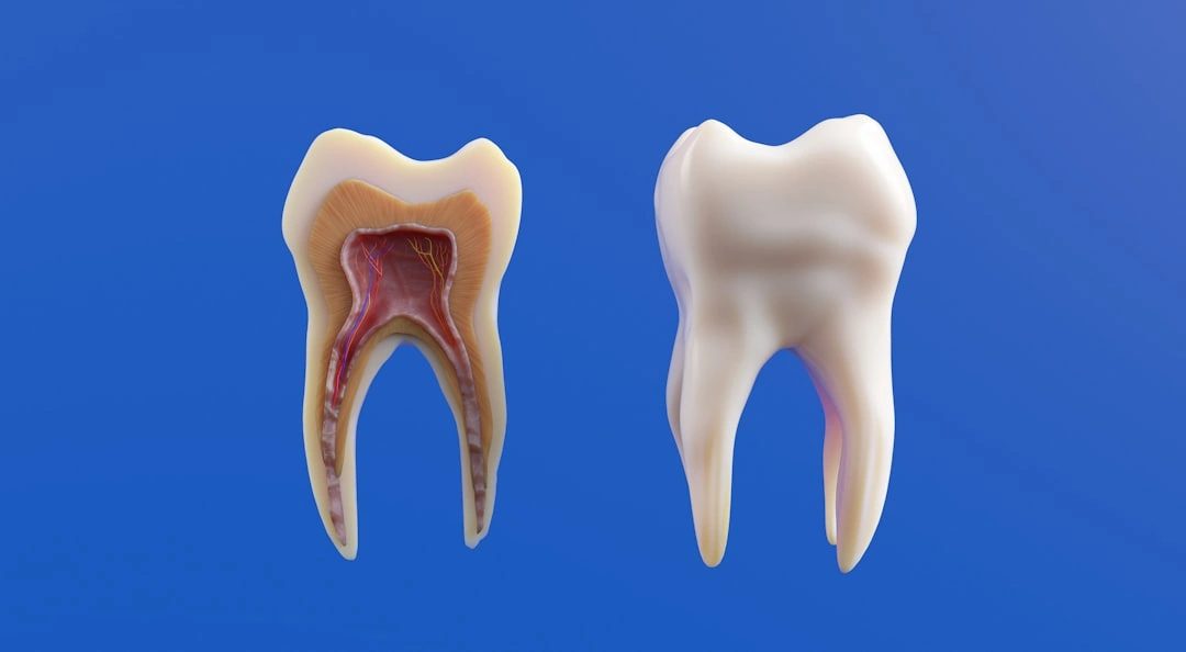 Comparison of complete, partial, and implant-supported denture types - dentures bellefontaine ohio Comparison of complete, partial, and implant-supported denture types - dentures bellefontaine ohio