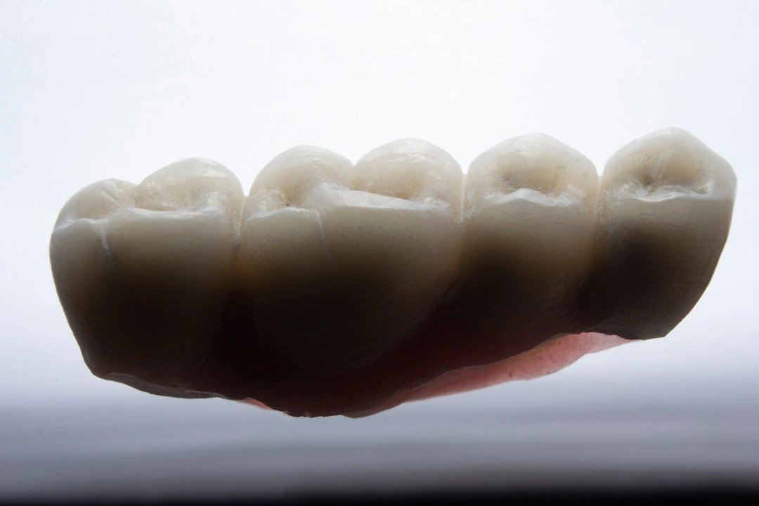 Comparing different dental bridge types