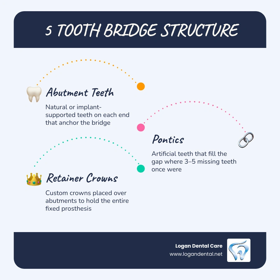 Diagram showing 5-tooth bridge structure with abutments, pontics, and crown components labeled infographic Diagram showing 5-tooth bridge structure with abutments, pontics, and crown components labeled infographic