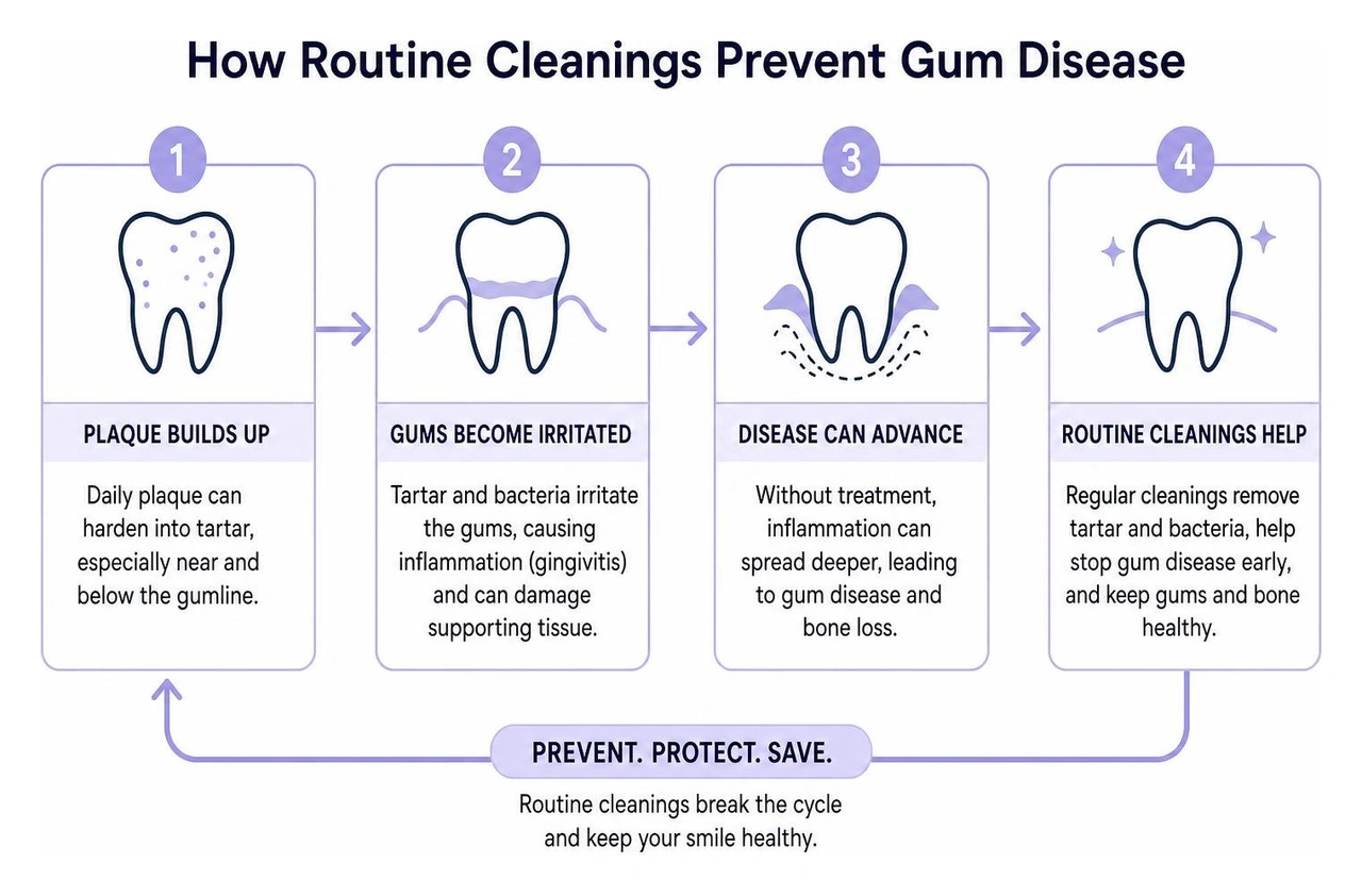 Diagram showing how routine cleanings prevent gum disease Diagram showing how routine cleanings prevent gum disease