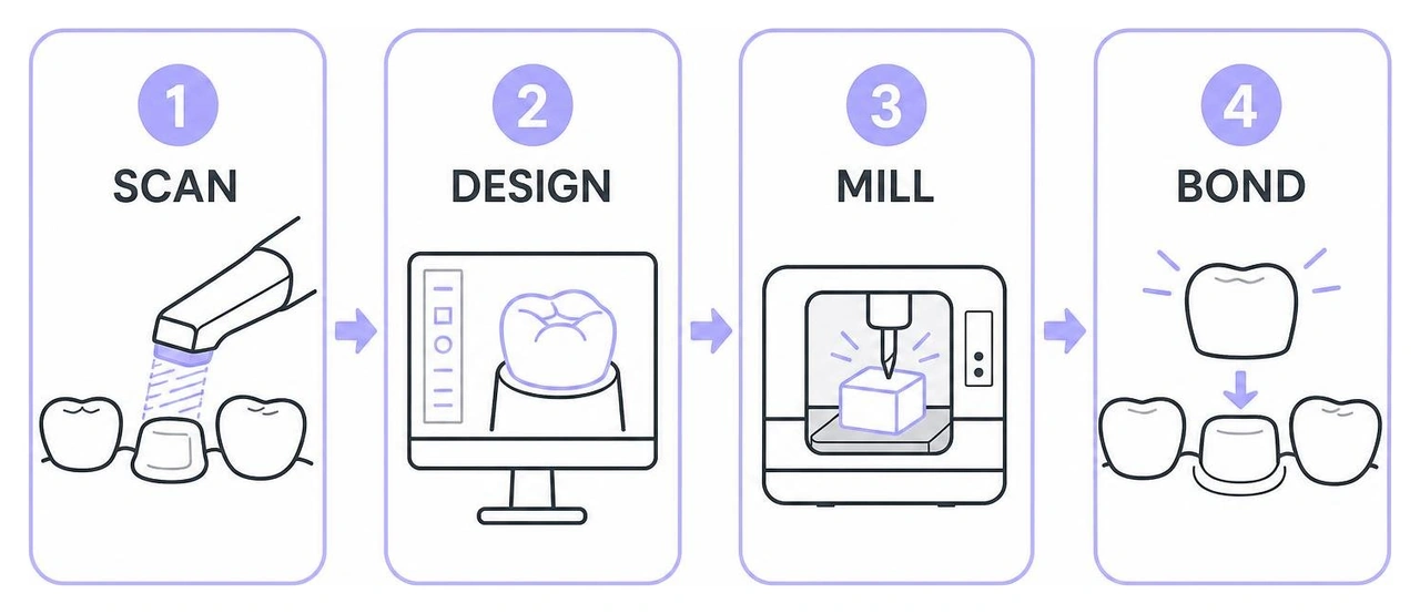 Diagram of CEREC same-day crown process: scan, design, mill, bond