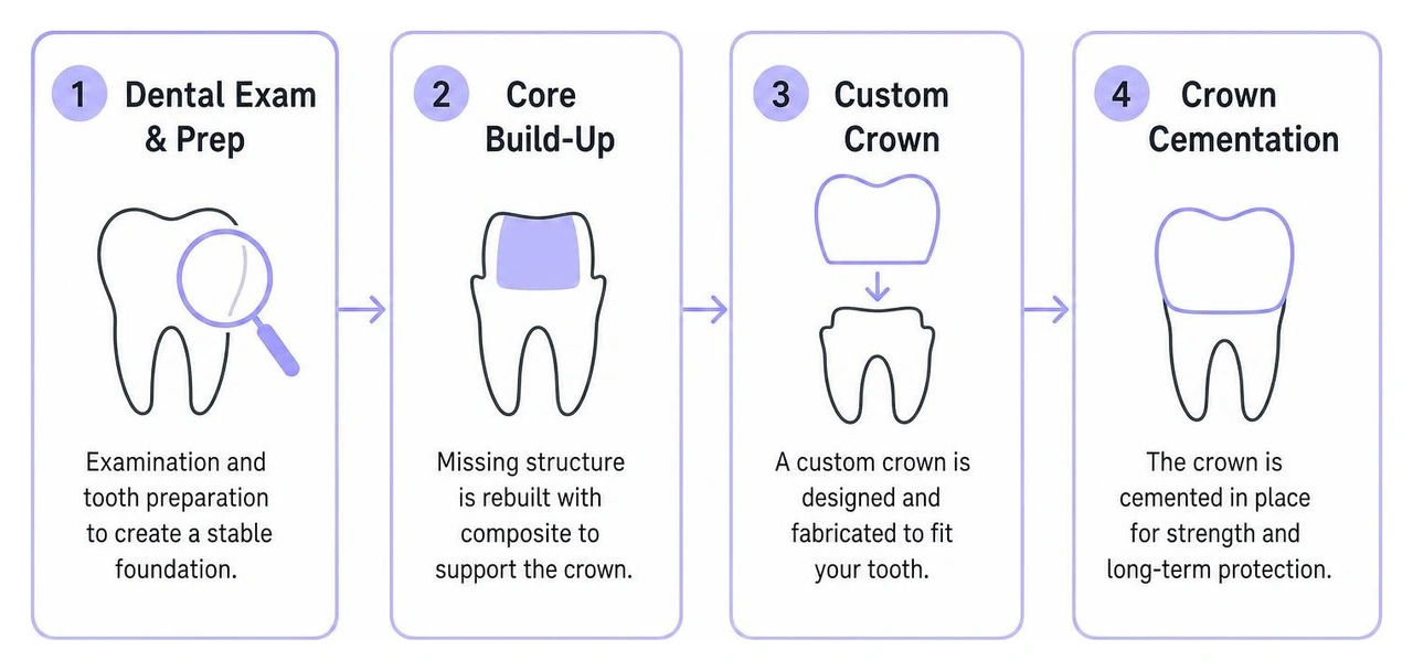 Treatment flow from dental exam and prep to core build-up and final crown cementation Treatment flow from dental exam and prep to core build-up and final crown cementation
