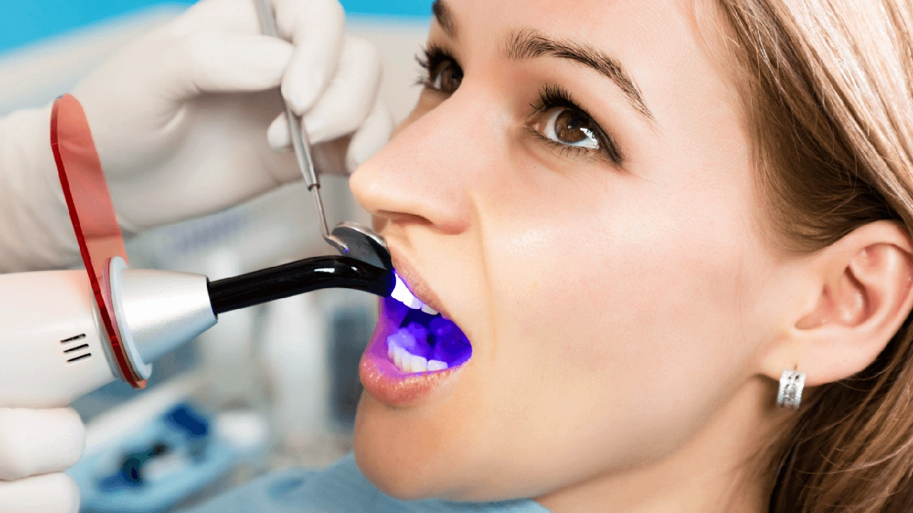 Dentist performing a tooth core build-up Dentist performing a tooth core build-up
