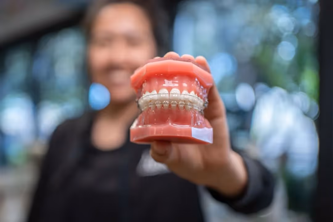 The Dangers of “At-Home Braces”: Why DIY Orthodontics Can Harm More Than Help