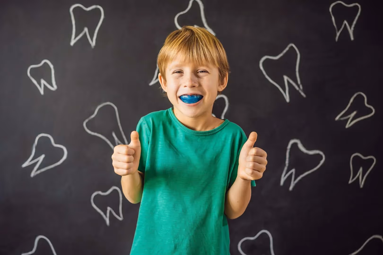 Custom Mouthguards for Sports: Protecting Your Investment in Orthodontics