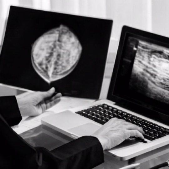 Person holding a medical scan while using a laptop showing another scan image on its screen.