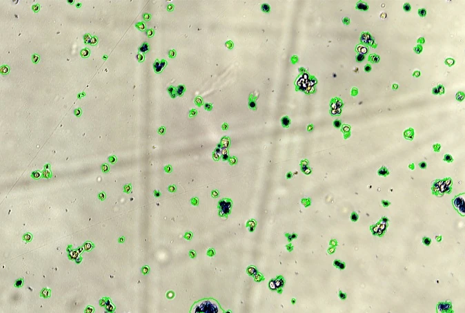Brightfield image of a well with each of the 325 segmented cells outlined in green