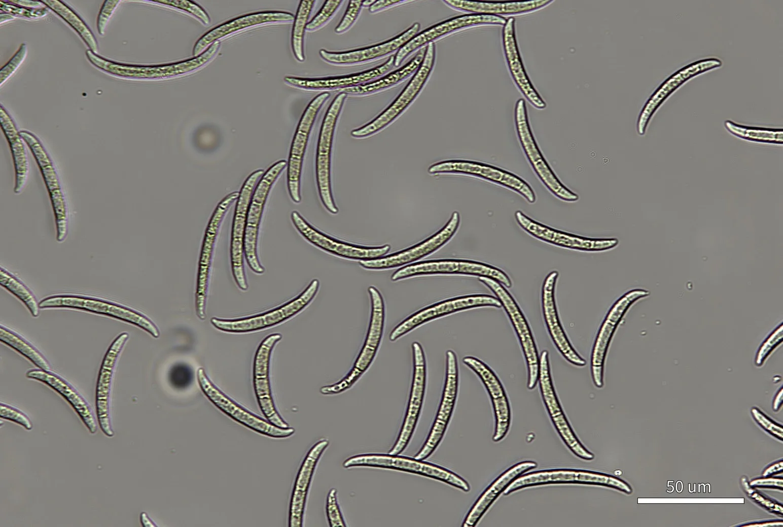 Brightfield image of live, unstained Fusarium spores