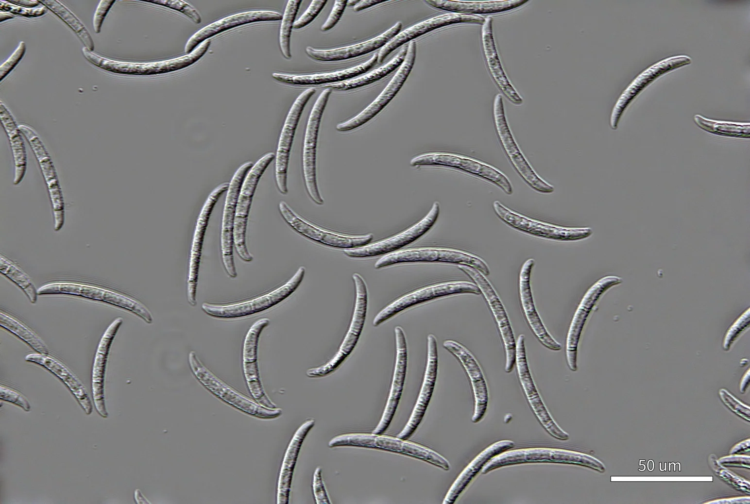 DIC image of the same spores