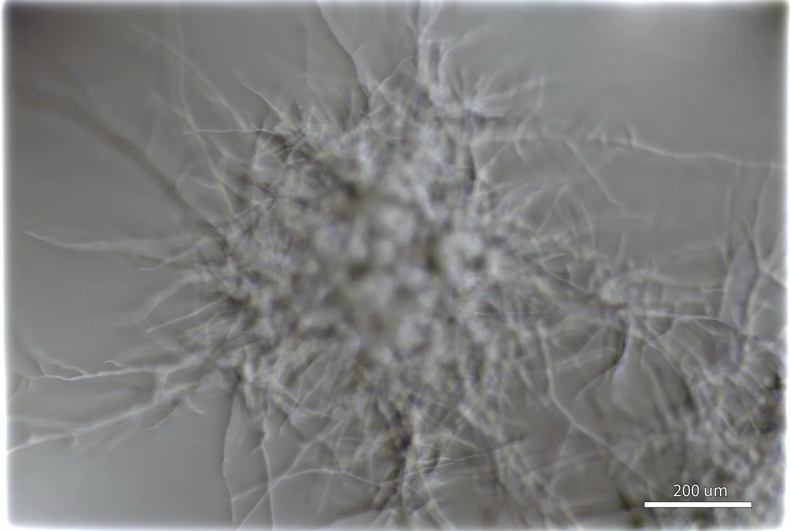 Quantitative phase image of the same mycelium