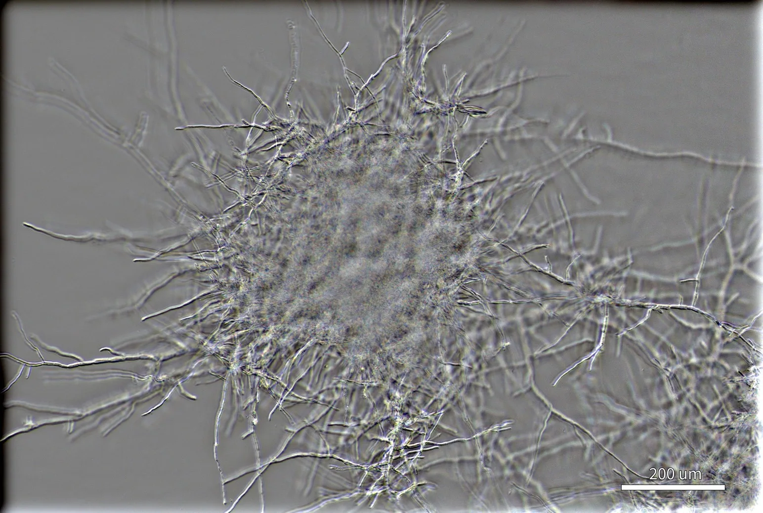 DIC image of the same mycelium