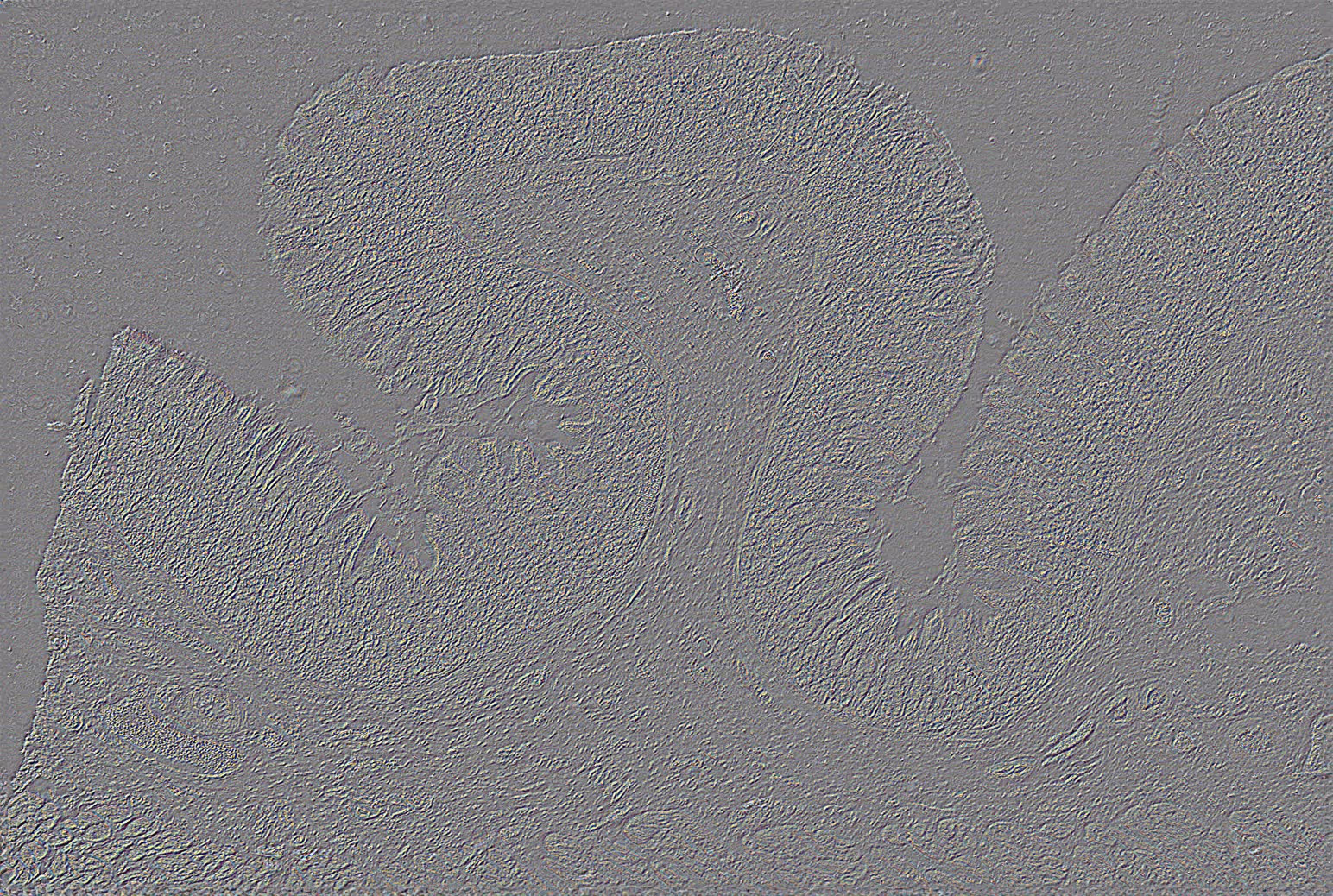 Quantitative phase image of the same tissue sample