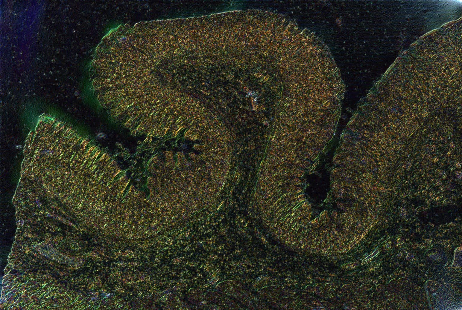 Scattering amplitude image of the same tissue sample