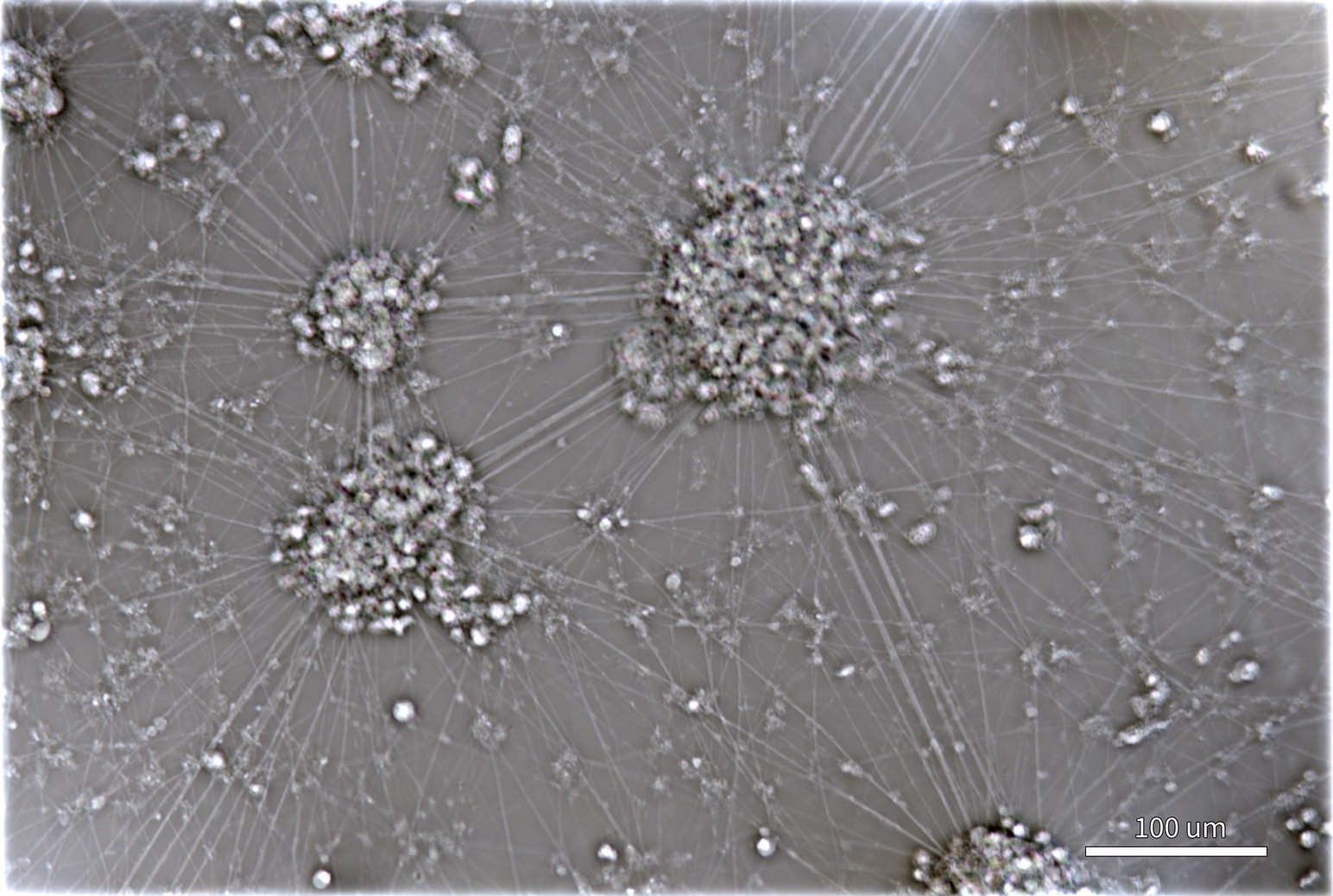 Quantitative phase image of the same neurons