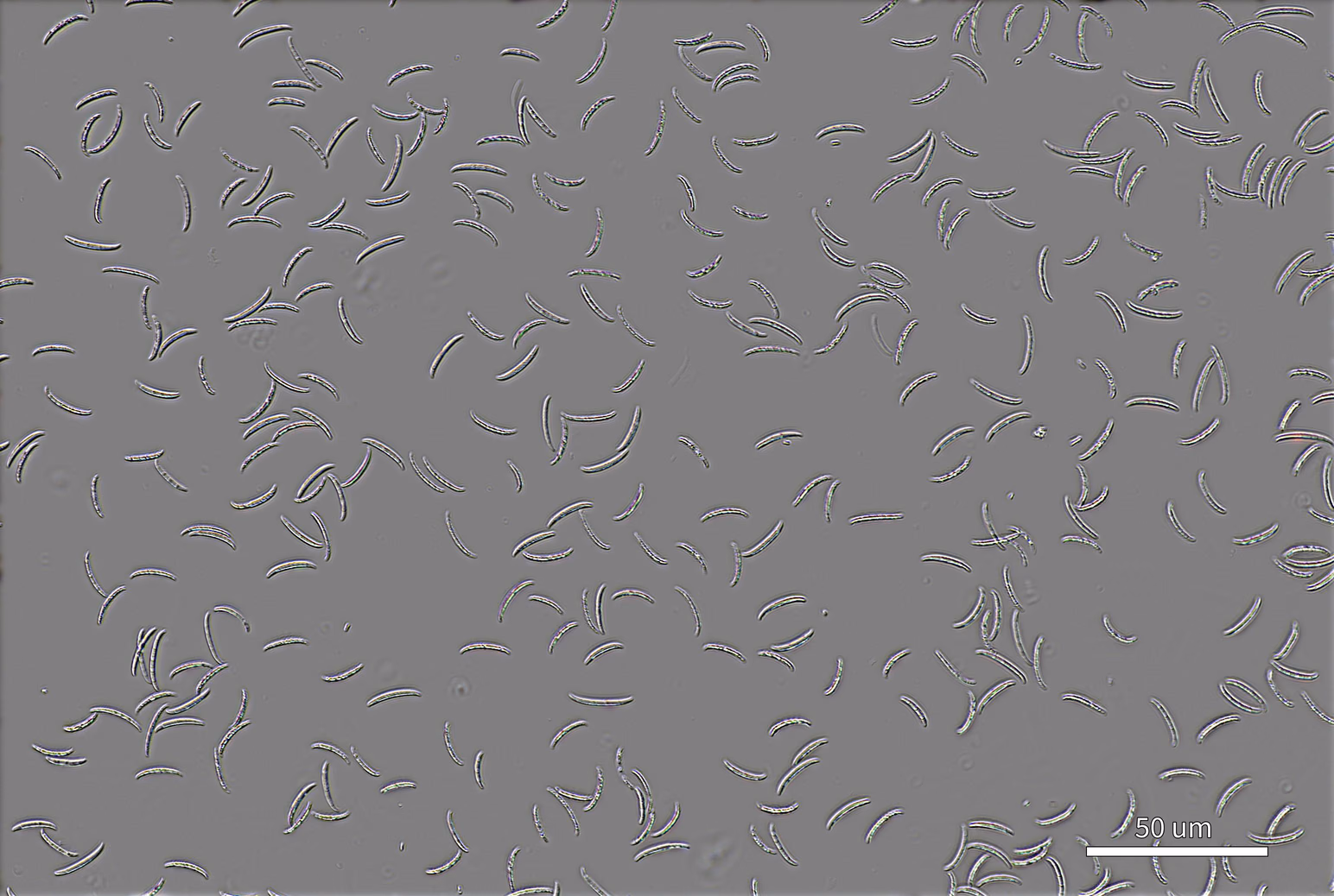 DIC image of the same spores