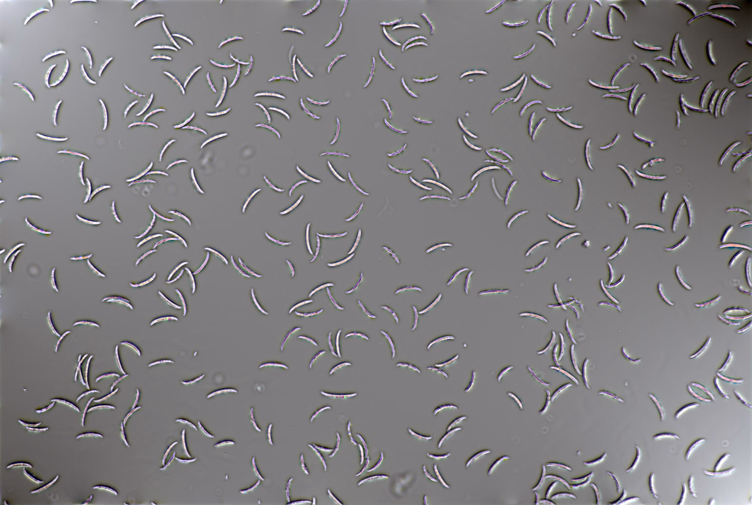 Quantitative phase image of the same spores