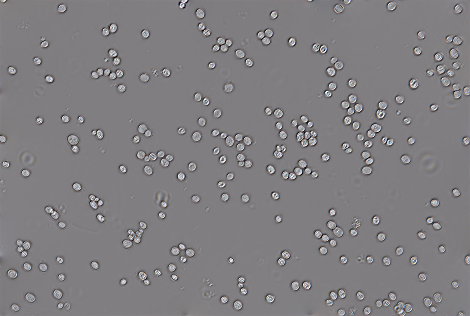 Quantitative phase image of the same yeast cells