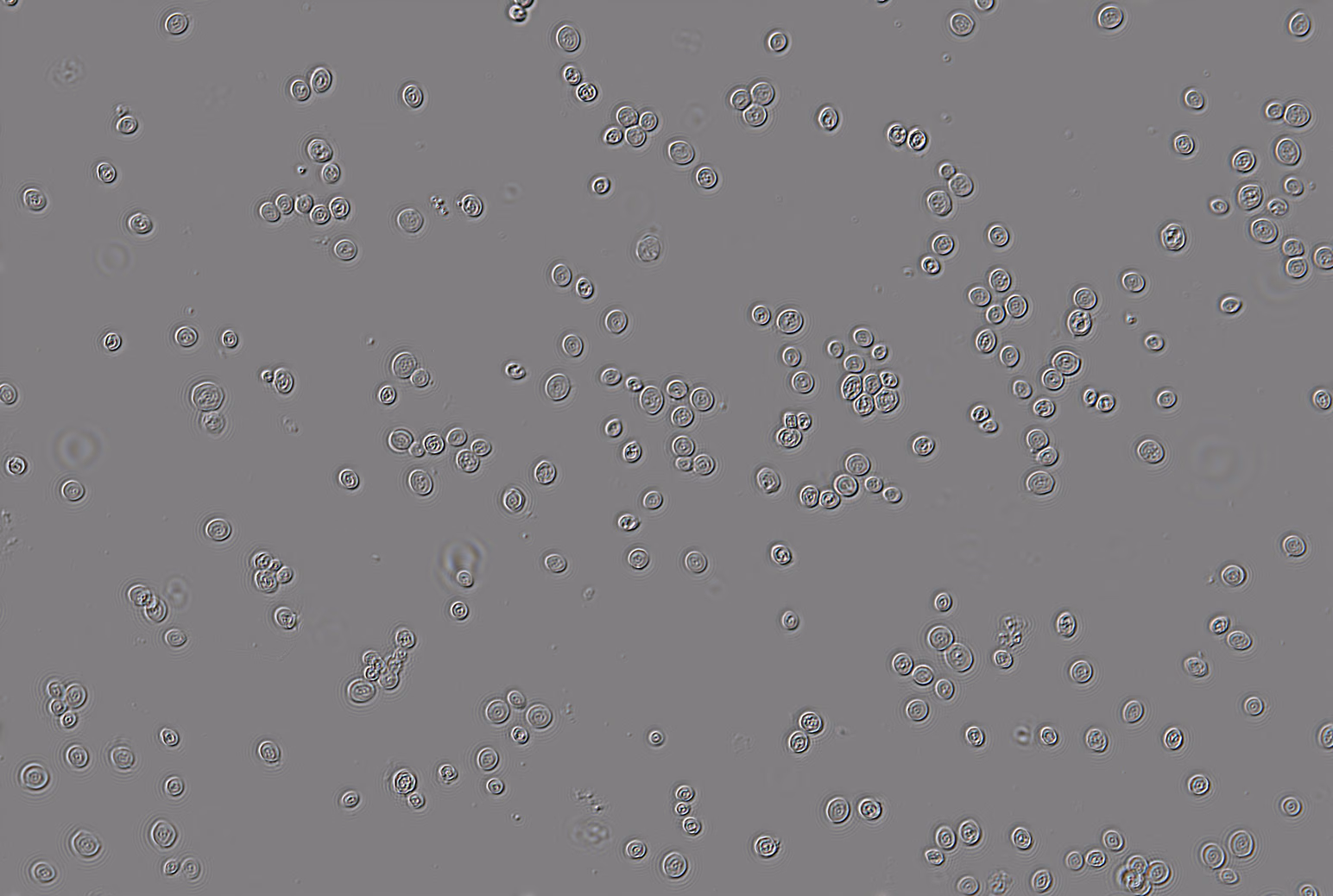 DIC image of the same yeast cells